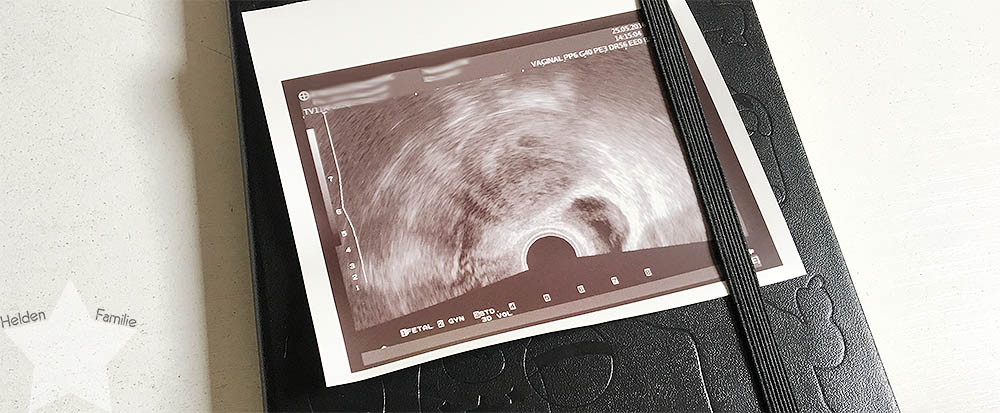 erster Ultraschall - 5+6 - 6. Schwangerschaftswoche - 3. Kind