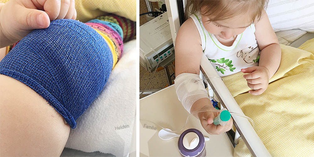 Nach dem Eingriff - Verband am Knie und endlich gegessen